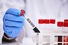 Первый случай серозно-вирусного менингита зарегистрирован в Хабаровске